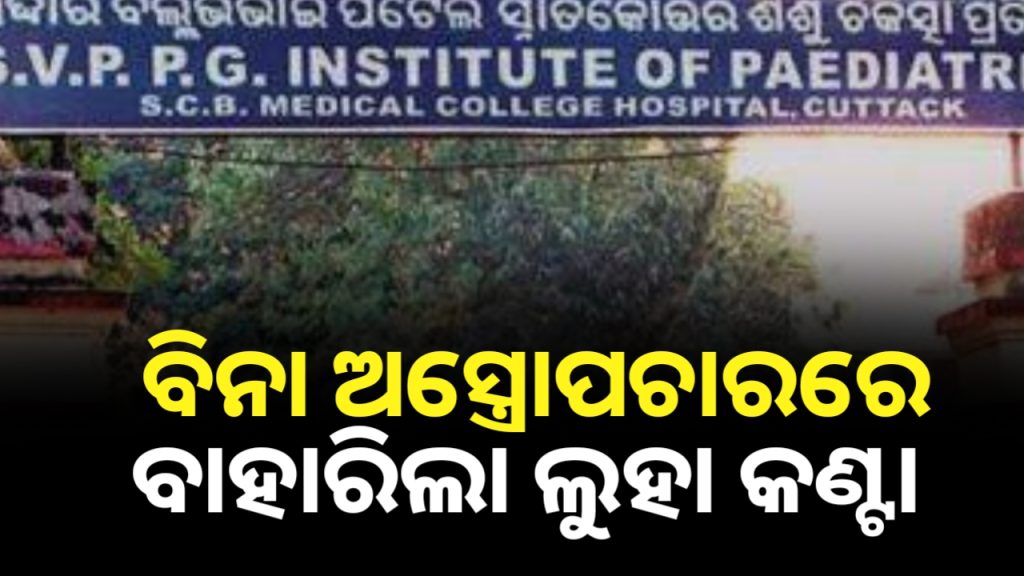 ବିନା ଅସ୍ତ୍ରୋପଚାରରେ ଶ୍ବାସ ନଳୀରୁ ବାହାରିଲା ଦେଢ ଇଞ୍ଚ ଲମ୍ବର ଏକ ଲୁହା କଣ୍ଟା